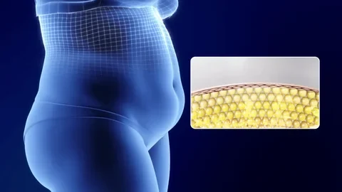 Illustration of the abdomen with an inset showing fat tissue